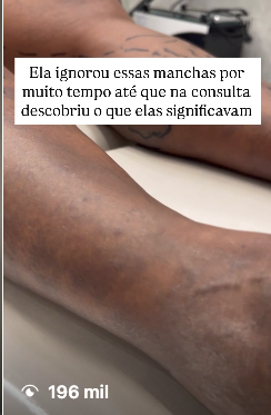 Conteúdo viral