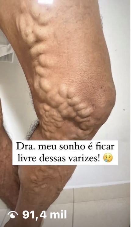 Conteúdo viral